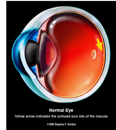 macular-degeneration-normal-eye